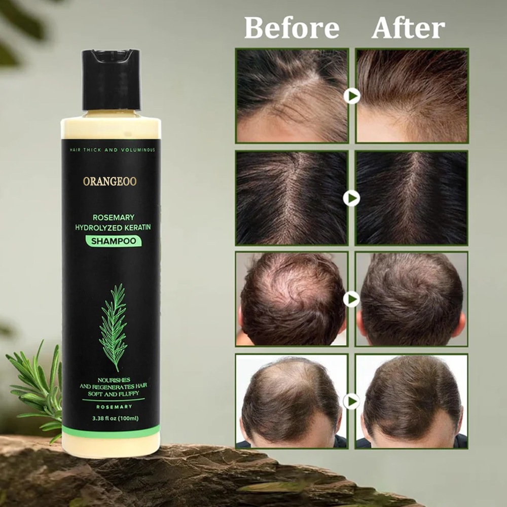🔥LAST DAY 50% OFF - 🌿Orangeoo® Organic Rosemary Hair Growth Shampoo