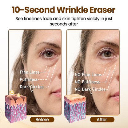 Velmora® Renewing 10s Wrinkle Serum